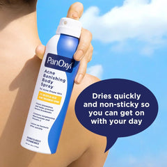 PanOxyl Acne Banishing Body Spray 2% Salicylic Acid - 6oz: Paraben-Free, Whole Body Application
